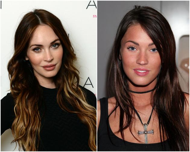 Megan-fox-chirurgia-estetica