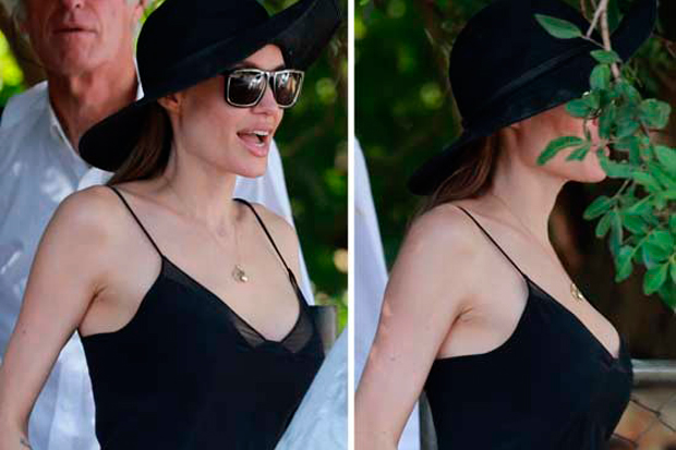 angelina-jolie-asportazione-ovaie