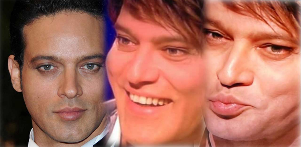 gabriel-garko-orrori-chirurgia