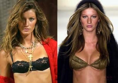 gisele-seno-rifatto