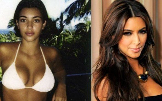 kim.kardashian.before.and_.after_