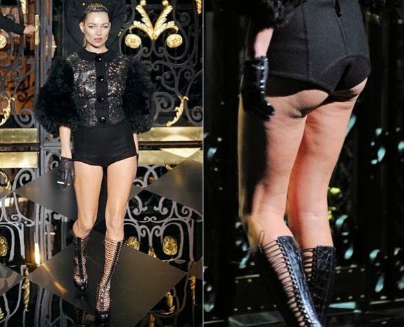 celulite kate moss